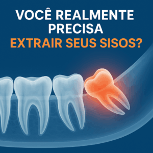 Ilustração cirurgia sisos