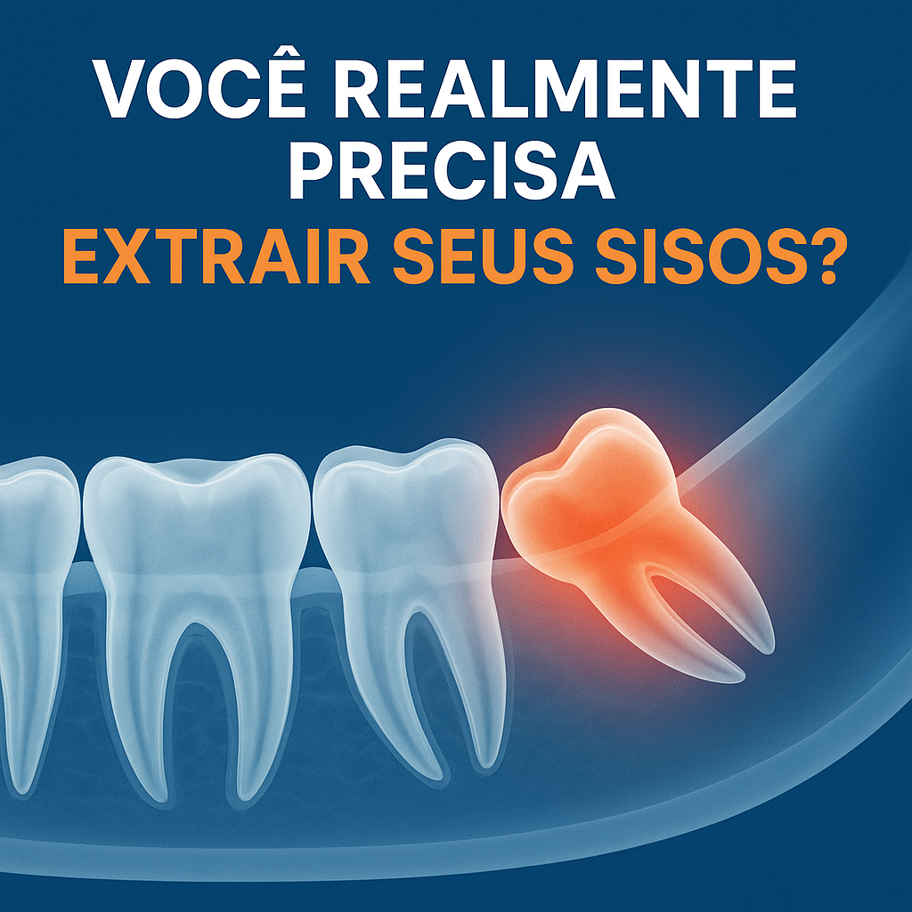 Ilustração cirurgia sisos